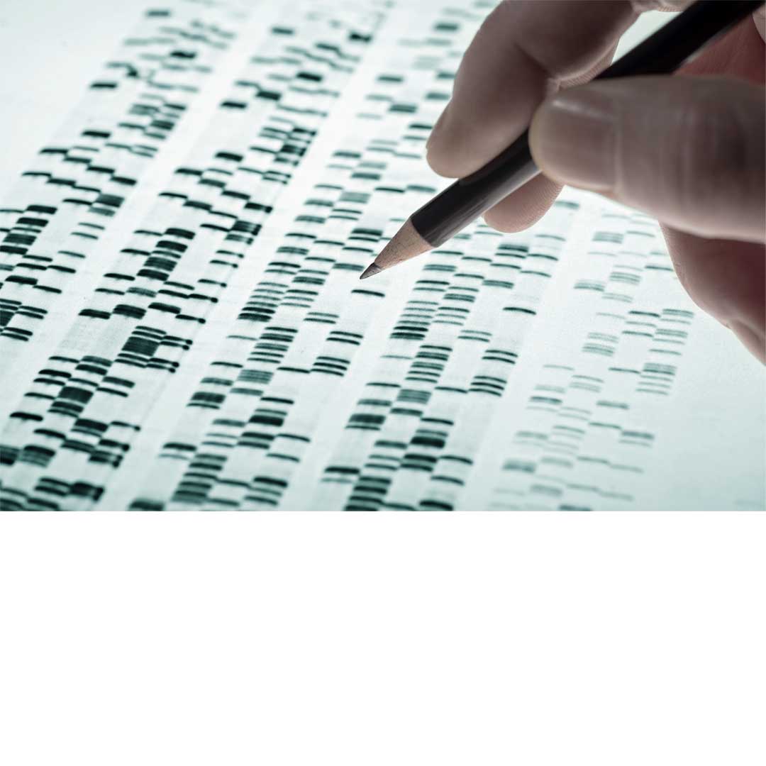 DNA analysis bands on a gel sheet with a hand marking results, illustrating biotech research and life sciences laboratory activity.